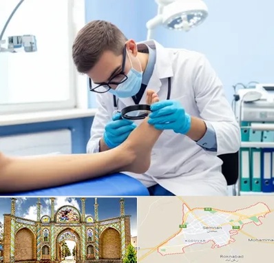 درمان زخم پای دیابتی در سمنان