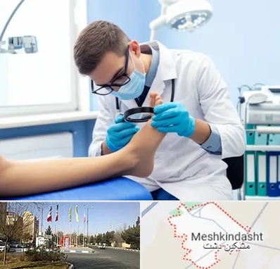 درمان زخم پای دیابتی در مشکین دشت