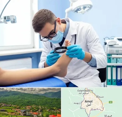 درمان زخم پای دیابتی در آمل