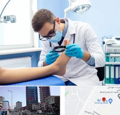 درمان زخم پای دیابتی در چهارراه طالقانی کرج 