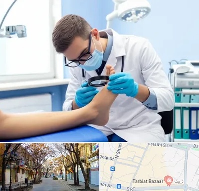 درمان زخم پای دیابتی در تربیت تبریز 