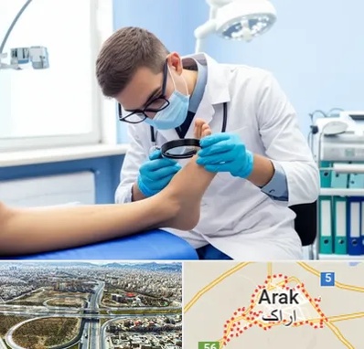درمان زخم پای دیابتی در اراک