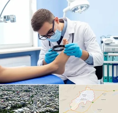 درمان زخم پای دیابتی در شاهرود