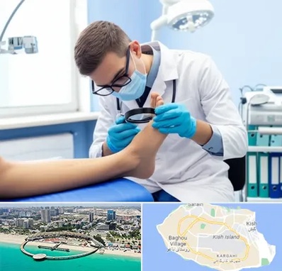 درمان زخم پای دیابتی در کیش