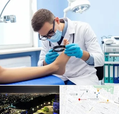 درمان زخم پای دیابتی در هفت تیر مشهد 