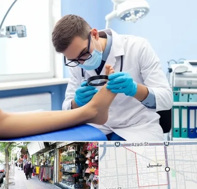 درمان زخم پای دیابتی در سلسبیل