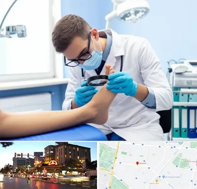 درمان زخم پای دیابتی در بلوار سجاد مشهد 