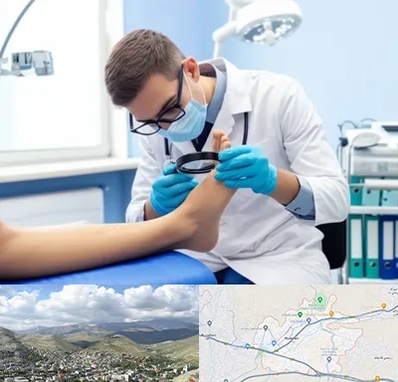 درمان زخم پای دیابتی در رودهن