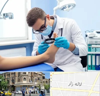 درمان زخم پای دیابتی در لاله زار