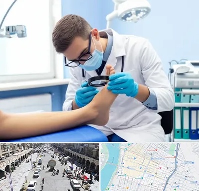 درمان زخم پای دیابتی در نادری اهواز 