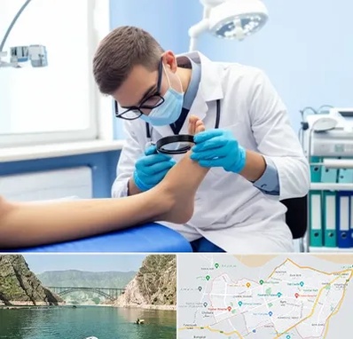 درمان زخم پای دیابتی در ایلام