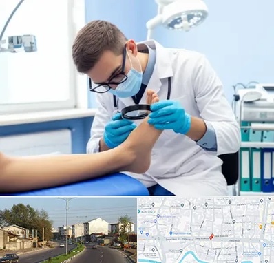 درمان زخم پای دیابتی در ضیابری رشت 