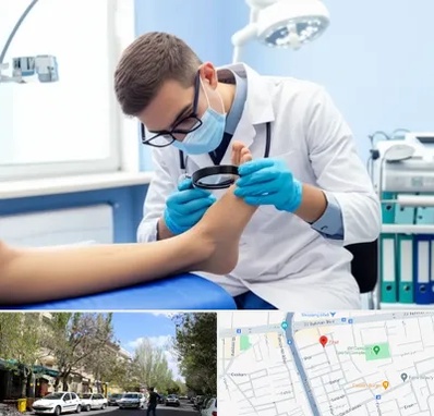 درمان زخم پای دیابتی در کوی فیروز تبریز 