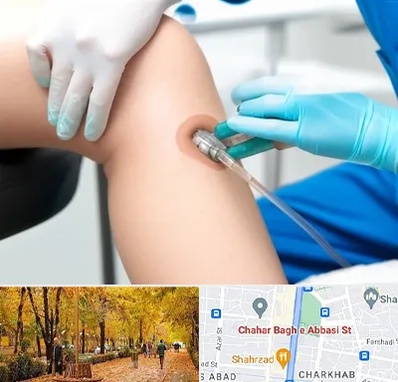 اوزون تراپی در چهارباغ اصفهان 