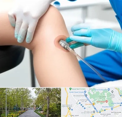 اوزون تراپی در قدوسی غربی شیراز 