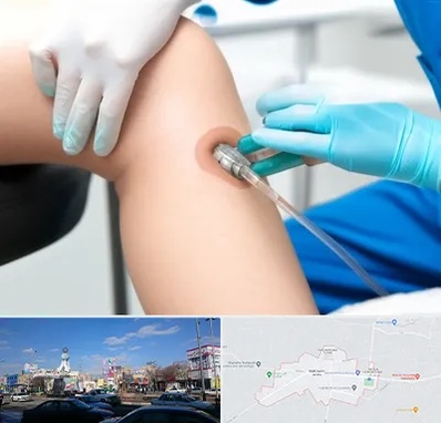 اوزون تراپی در ماهدشت کرج 