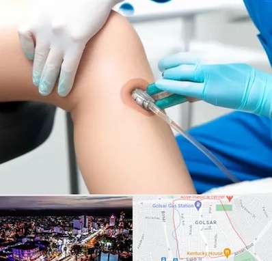 اوزون تراپی در گلسار رشت 