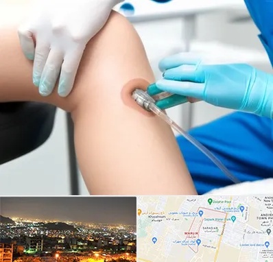 اوزون تراپی در مارلیک کرج 