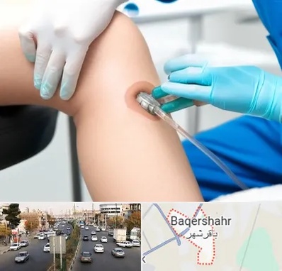 اوزون تراپی در باقرشهر