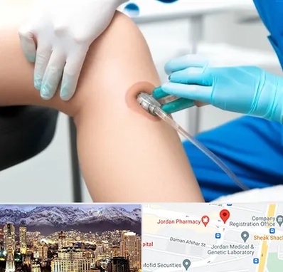 اوزون تراپی در جردن 