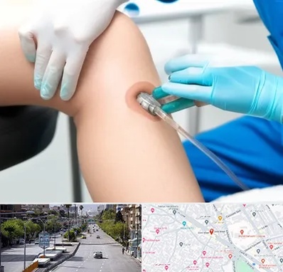 اوزون تراپی در خیابان زند شیراز 