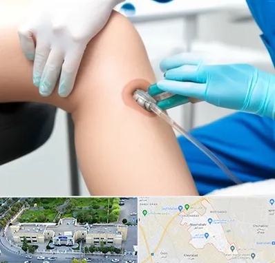 اوزون تراپی در نسیم شهر