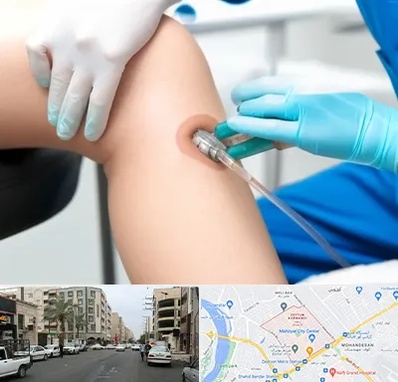 اوزون تراپی در زیتون کارمندی اهواز 