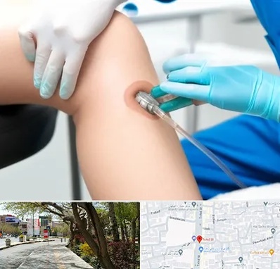 اوزون تراپی در خیابان توحید اصفهان 