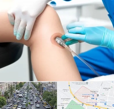 اوزون تراپی در گلشهر کرج 