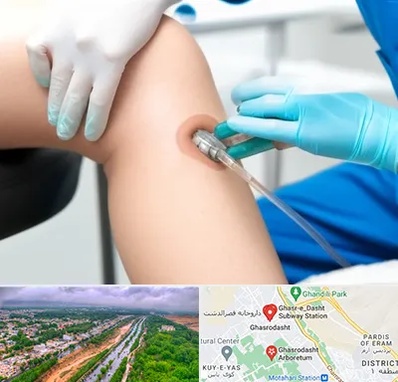 اوزون تراپی در قصرالدشت شیراز 