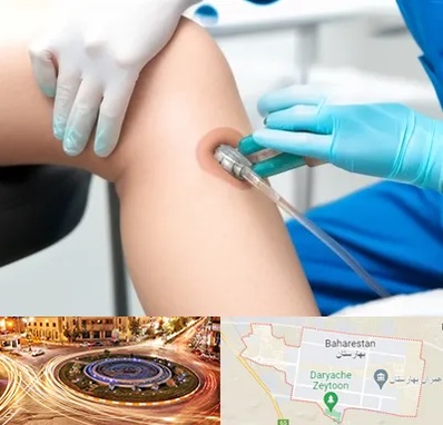 اوزون تراپی در بهارستان