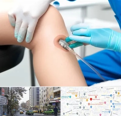 اوزون تراپی در فاطمی