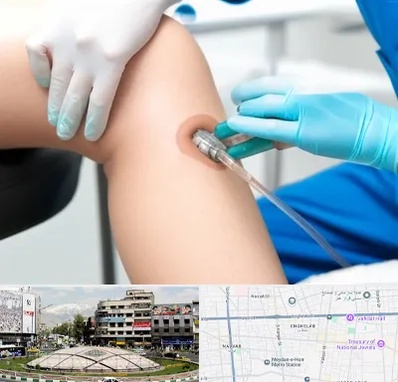 اوزون تراپی در مرکز تهران 