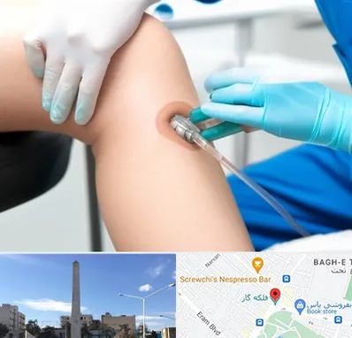 اوزون تراپی در فلکه گاز شیراز 