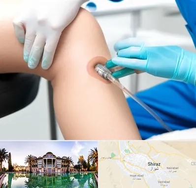 اوزون تراپی در شیراز