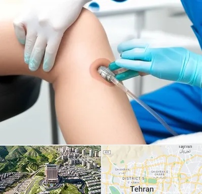 اوزون تراپی در شمال تهران 