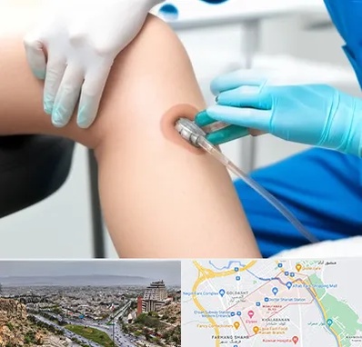 اوزون تراپی در معالی آباد شیراز 