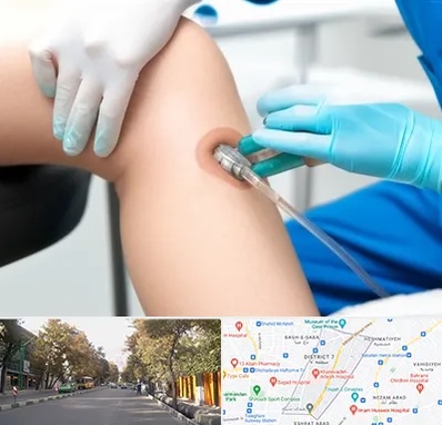 اوزون تراپی در شریعتی 