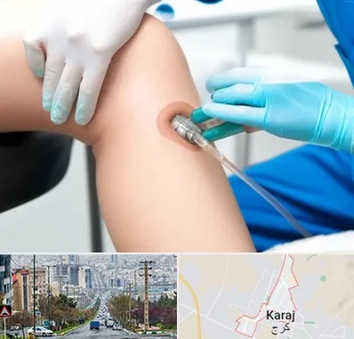 اوزون تراپی در گوهردشت کرج 