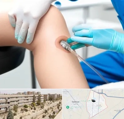 اوزون تراپی در واوان اسلامشهر 