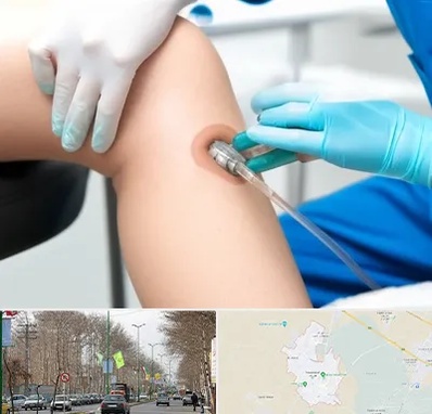 اوزون تراپی در نظرآباد کرج 