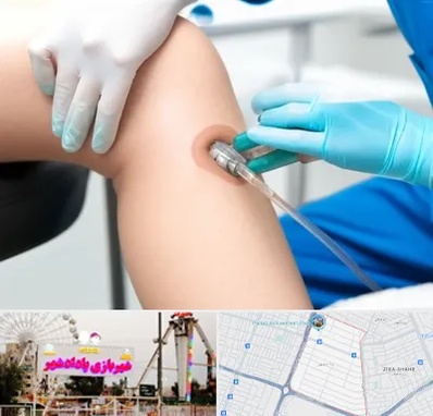 اوزون تراپی در پادادشهر اهواز 