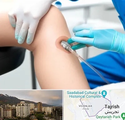 اوزون تراپی در زعفرانیه