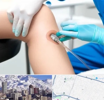 اوزون تراپی در ازگل 