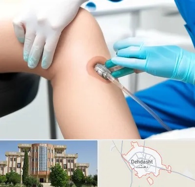 اوزون تراپی در دهدشت