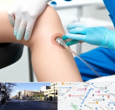 اوزون تراپی در خیابان ملاصدرا شیراز 