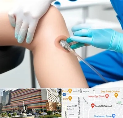 اوزون تراپی در سهروردی 