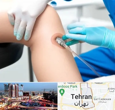 اوزون تراپی در صادقیه