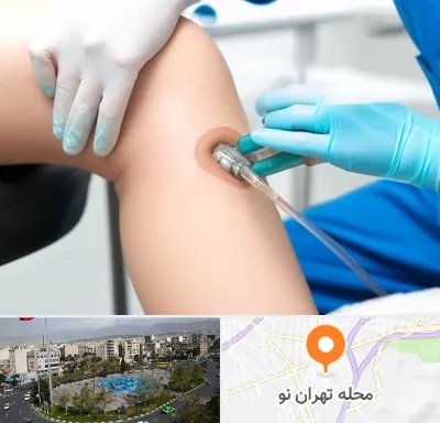 اوزون تراپی در تهران نو
