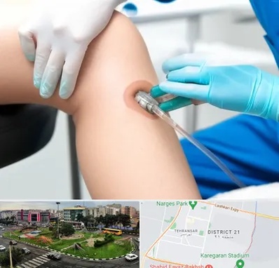 اوزون تراپی در تهرانسر 